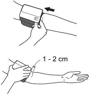 Applying the Arm Cuff - Step 1