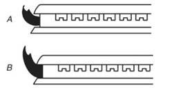 Adjust Surface Burner Flame - Step 1