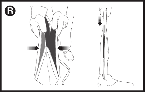 CORD RETAINER OPERATION - Step 3