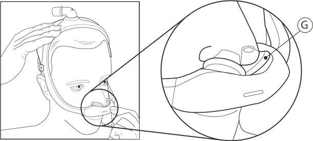 Achieving the Right Fit - Cushion Sizing