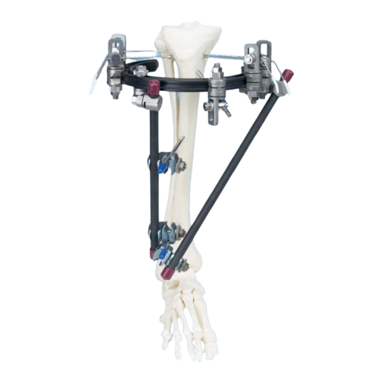 Synthes Hybrid Fixator Proximal Tibia Frame Technique Manual