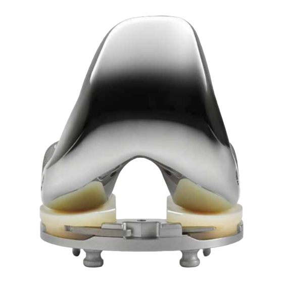 BIOMET VANGUARD XP MANUAL Pdf Download ManualsLib