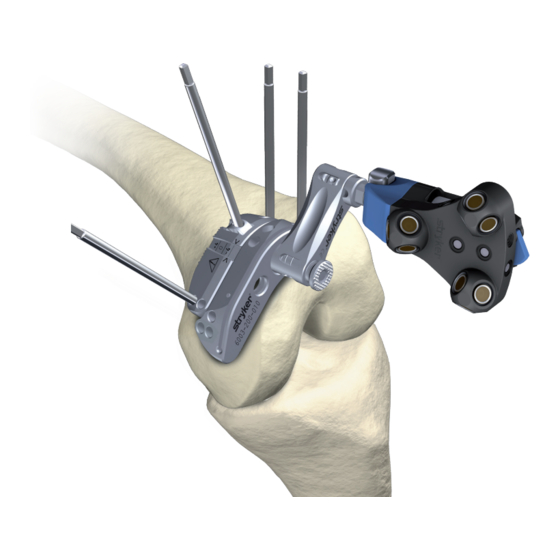 STRYKER NAVIGATED MIS JIGA INSTRUCTIONS FOR USE MANUAL Pdf Download