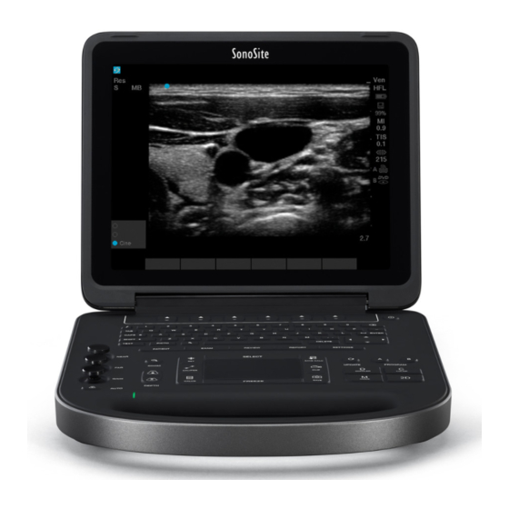 FujiFilm SonoSite Edge II User Manual Supplement