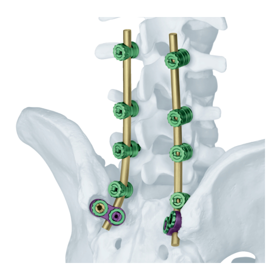 Synthes USS II Polyaxial Technique Manual