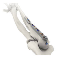 skeletal dynamics DISTAL ELBOW SET Surgical Technique Manual