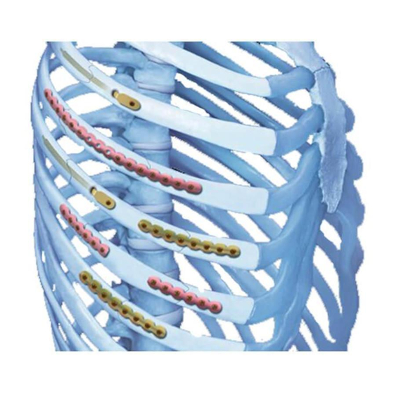 Synthes MatrixRIB Quick Reference