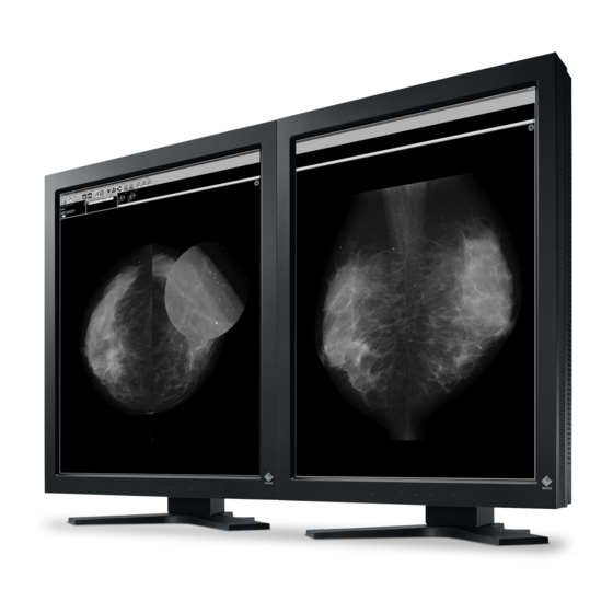 Eizo Digital Mammography Monitor Brochure & Specs
