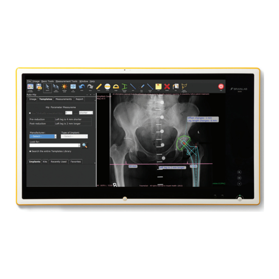 Brainlab Buzz Navigation System And Technical User Manual
