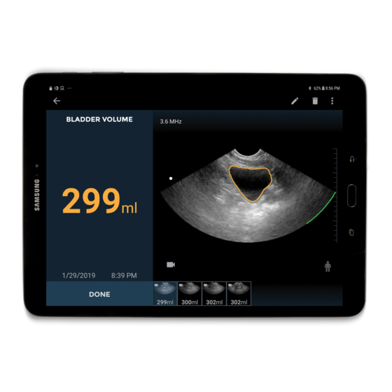 EchoNous Uscan Setup Manual