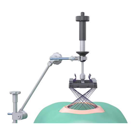 fasciotens Hernia Quick Manual