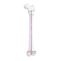 Synthes DFN 451.701 Surgical Technique